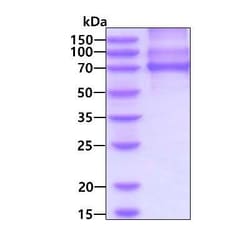 Novus Biologicals Recombinant Human PKC iota His Protein 500 &mu;g | Buy Online | Novus Biologicals&trade; | Fisher Scientific